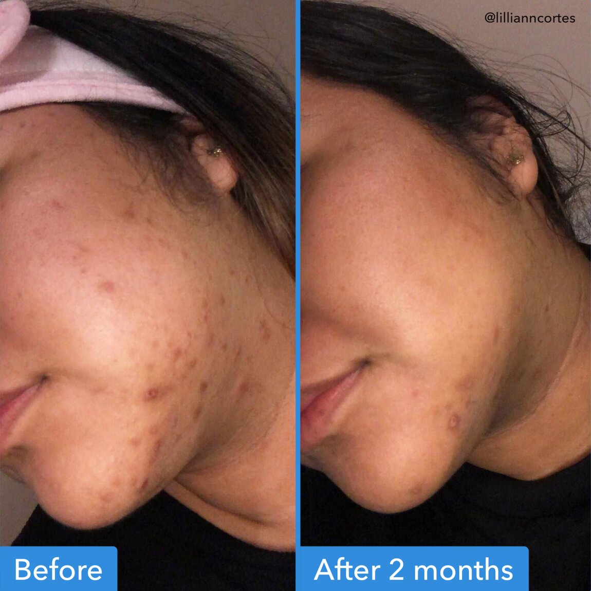 discoloration-correcting-serum-z9 zb_p.jpg