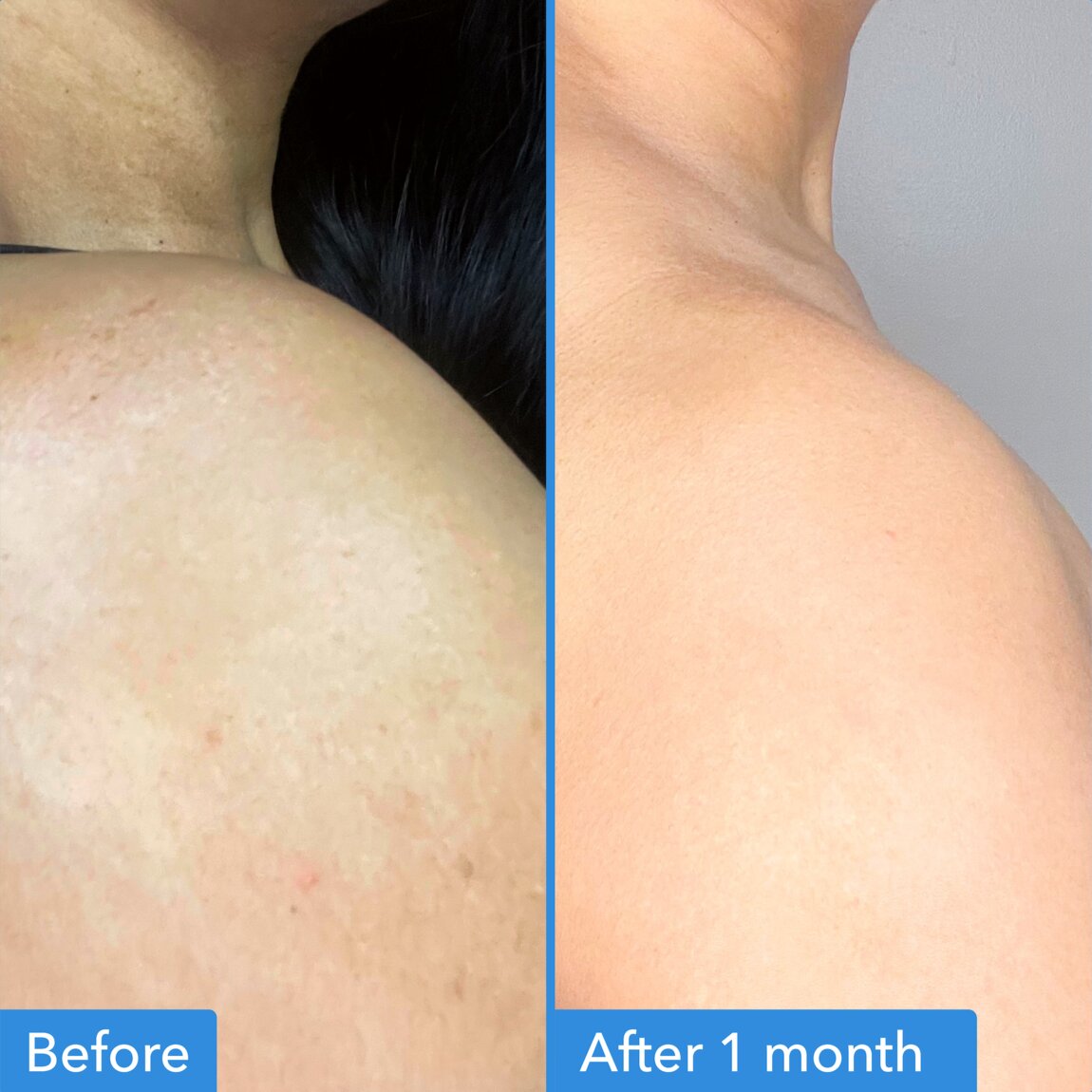 discoloration-correcting-body-treatment-c4 zb_p.jpg