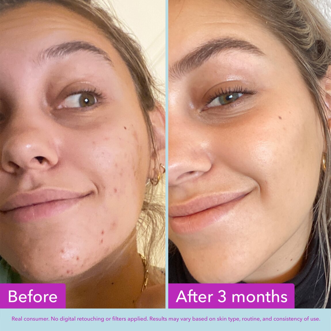 niacinamide-brightening-toner-k4 zb_p.jpg